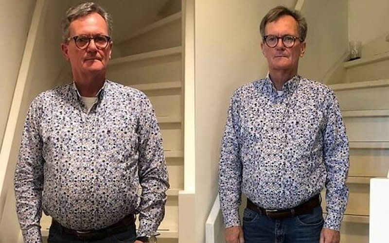 Hannelore Vorher-Nachher